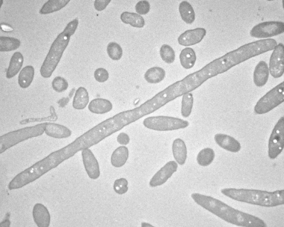 Transmission electron microscope image of Delftia tsuruhatensis.